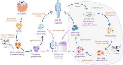 Monogenic Diabetes Modeling: In Vitro Pancreatic Differentiation From Human Pluripotent Stem Cells Gains Momentum